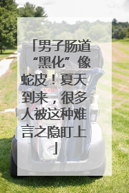 男子肠道“黑化”像蛇皮！夏天到来，很多人被这种难言之隐盯上